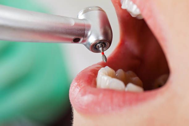 Best Weekend Emergency Dentist in Lovettsville, VA